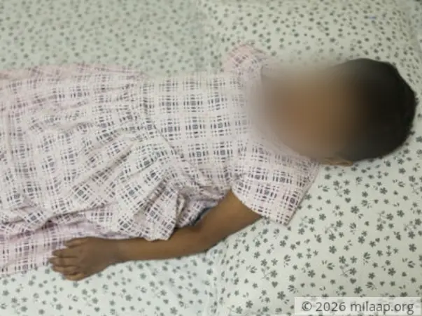 Geetha's Liver Disease Makes Her Scratch Her Skin Till It Bleeds