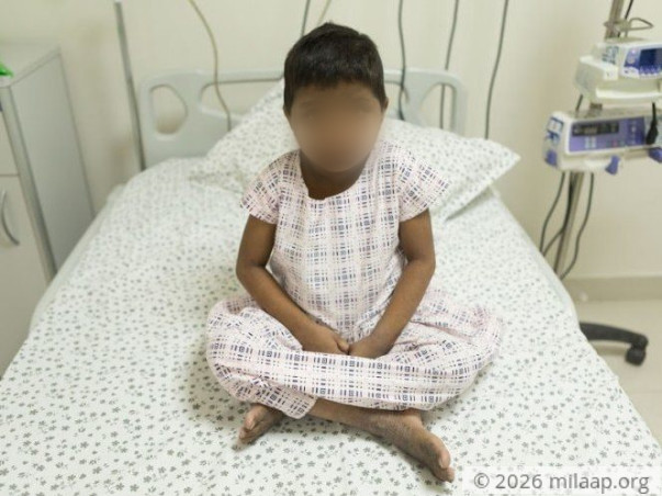 Geetha's Liver Disease Makes Her Scratch Her Skin Till It Bleeds