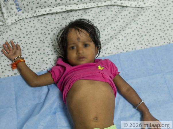 Harshini Needs An Urgent Liver Transplant To Survive A Fatal Disease