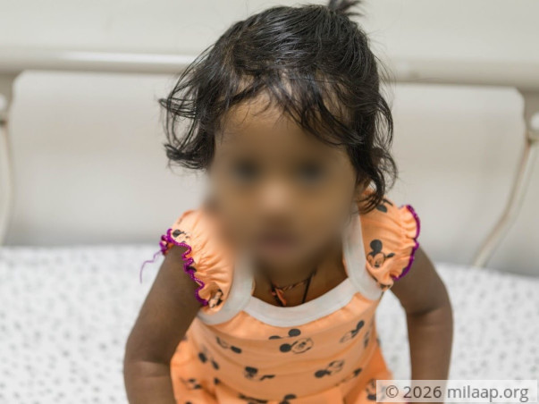 Harshini Needs An Urgent Liver Transplant To Survive A Fatal Disease