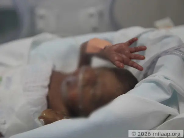 Help Sarmistha Save Her Premature Twin Babies
