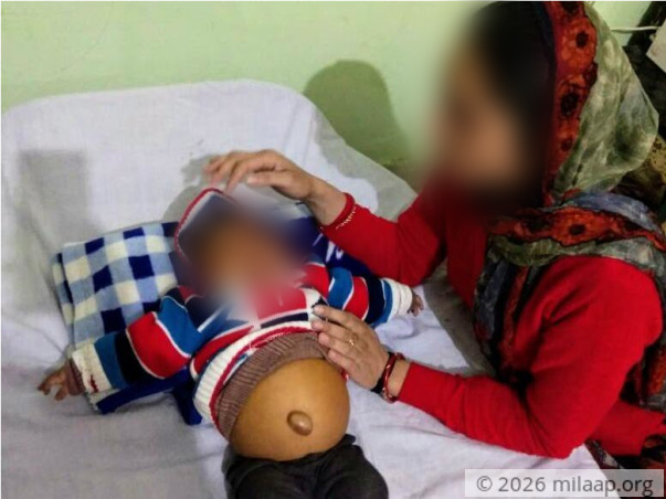 Help This 6-Month-Old Baby Girl Whose Stomach Is Bloating Every Second