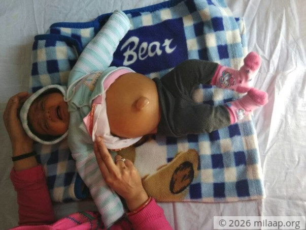 Help This 6-Month-Old Baby Girl Whose Stomach Is Bloating Every Second