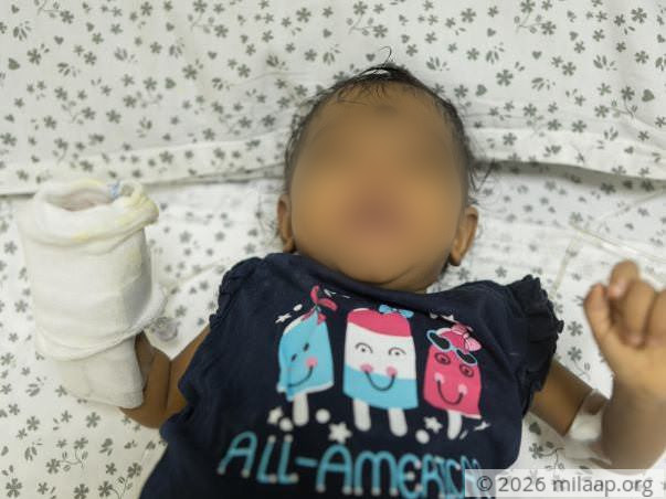 Help 6 month old baby girl Naidhruva fight a severe liver disease