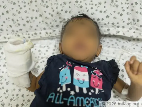 Help 6 month old baby girl Naidhruva fight a severe liver disease