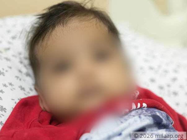 This 6-month-old baby boy is fighting a severe liver disease