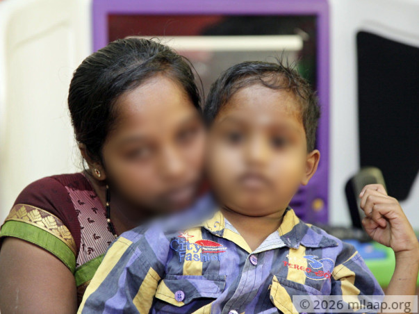 This 6-year-old boy can only survive with chemotherapy