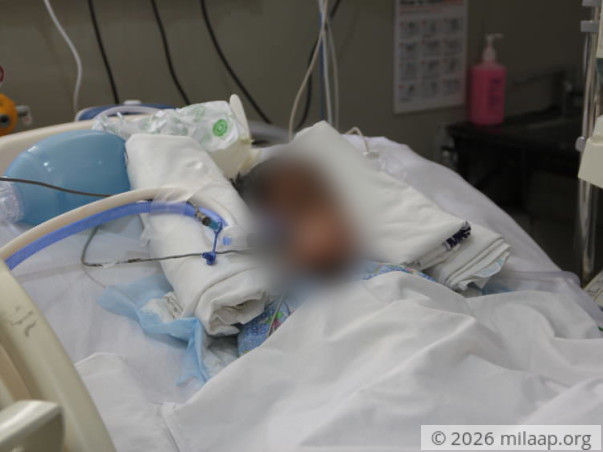 This 5-year-old boy is fighting a severe brain condition