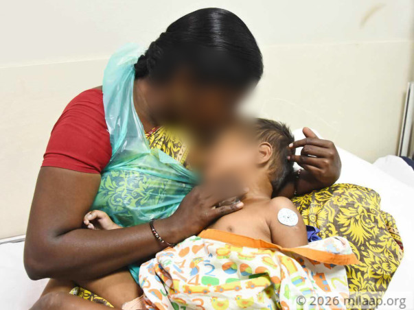 Our Son Will Take His Last Breath If He Does Not Get A Heart Surgery