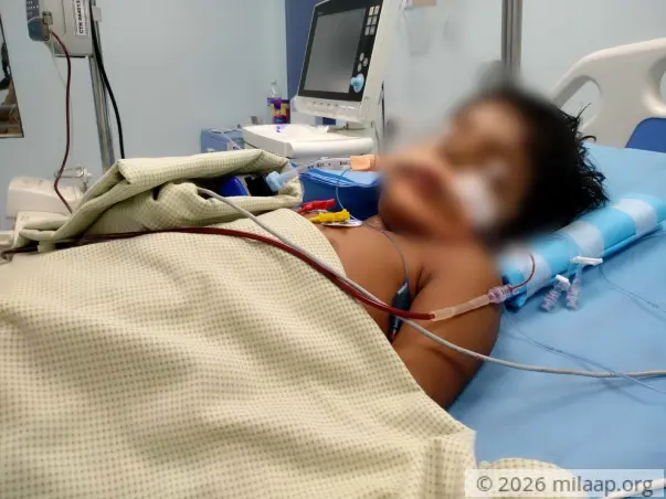 5-year-old Nivetha is fighting to stay alive after a Pneumonia attack