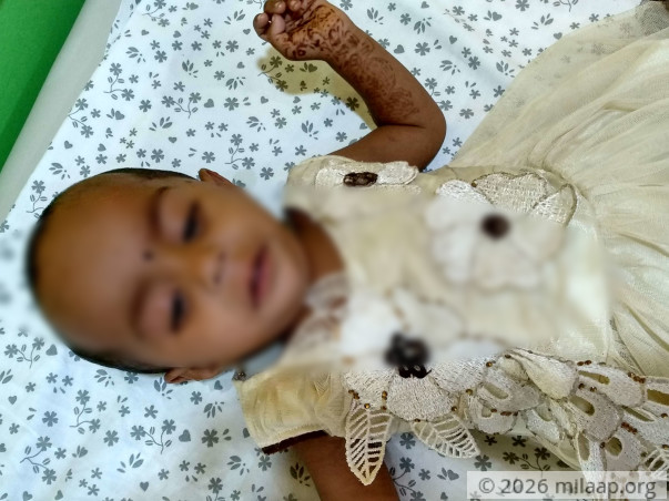 This Baby Has A Rare Birth Defect That Is Killing Her From Inside