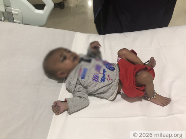 Help 6-Month-Old Daksh Undergo An Urgent Heart Surgery