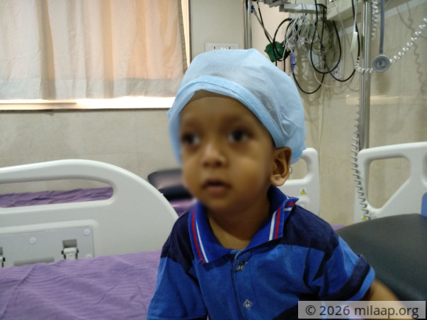 This baby boy will lose his vision without a bone marrow transplant