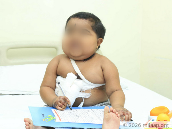 3-year-old Ancelet Will Die Like Her Siblings Without Urgent Help