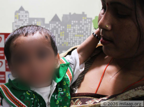 This Baby Gasps For Breath Every Single Day Due To Large Hole In Heart