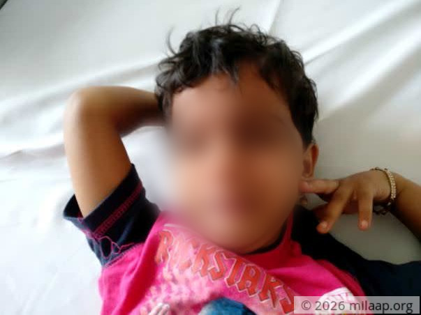 School Teacher's Daughter With 2 Massive Holes In Her Heart Needs Help