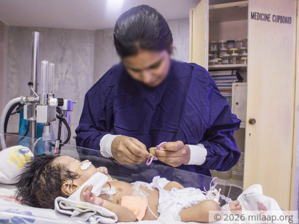 This Baby Boy Born Without Food Pipe Will Die Without Treatment