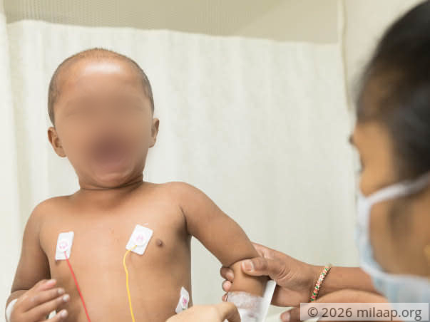 Hyderabad Constable Fights To Save 2-year-old Daughter From Cancer