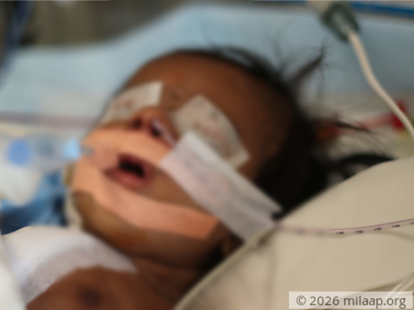 Farmer's 2-Month-Old Can Fight Heart Disease With Your Help