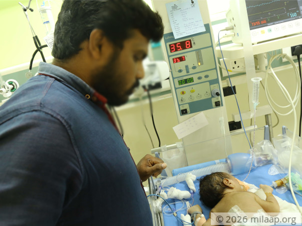 Unemployed For Almost A Month Now, Father Needs Help To Save His Baby