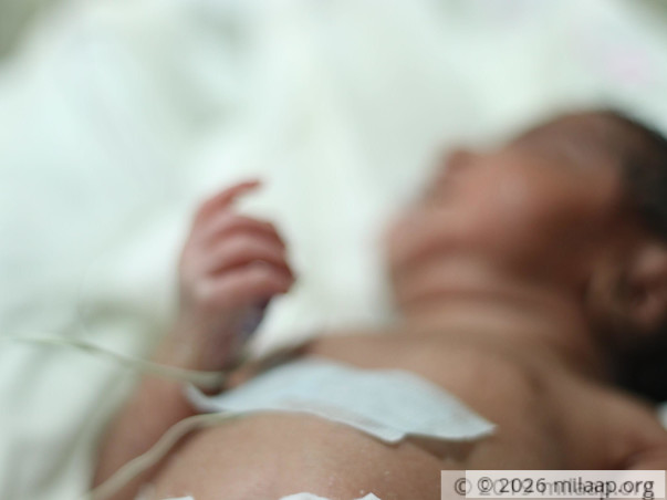 Surviving On Minimal Wages, This Father Can't Save His Newborn's Life