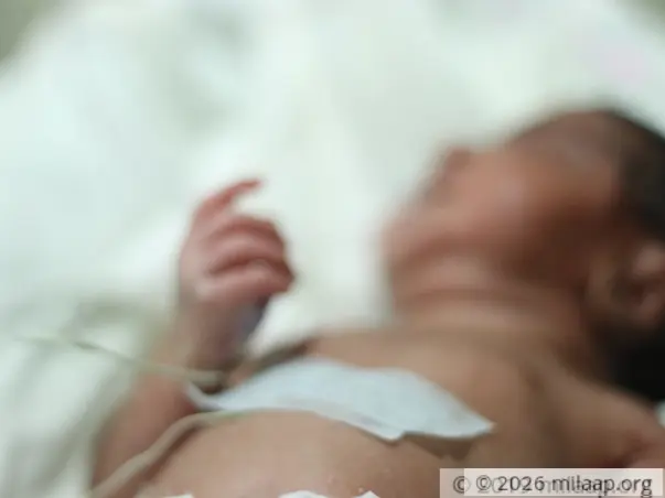 Surviving On Minimal Wages, This Father Can't Save His Newborn's Life