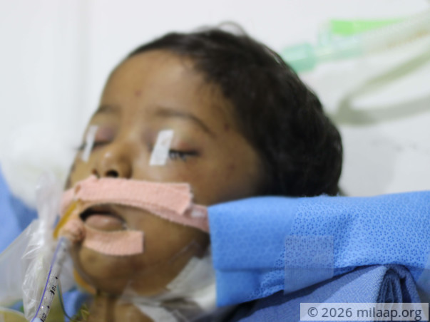 Nadeem Met With An Accident. Please Help Save Him!