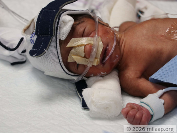 Forced To Stay Apart While Their Newborn Is Critical In The ICU