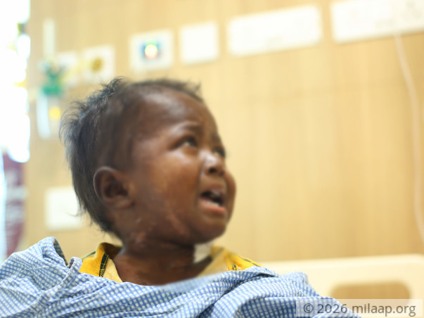 2-year-old May Die Of Cancer Because He Does Not Have An  Aadhar Card