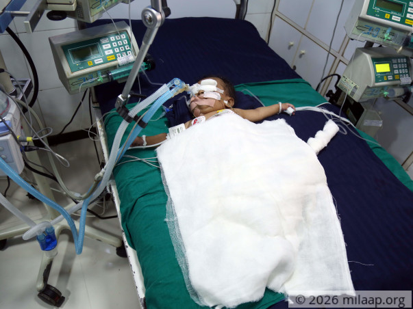 Anayasha needs your help to undergo her treatment