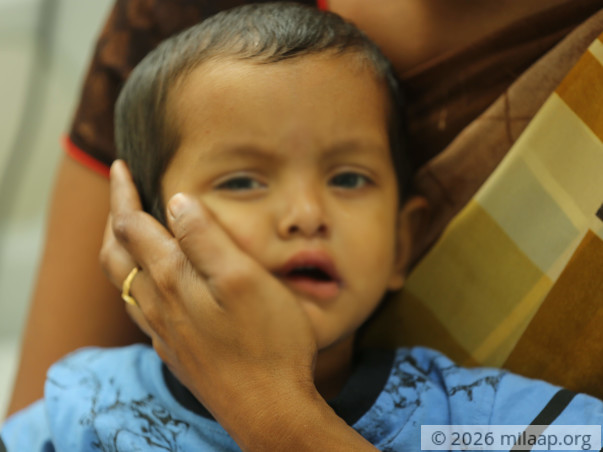 It Took A Year To Find What Was Killing Yaswanth - Save Him