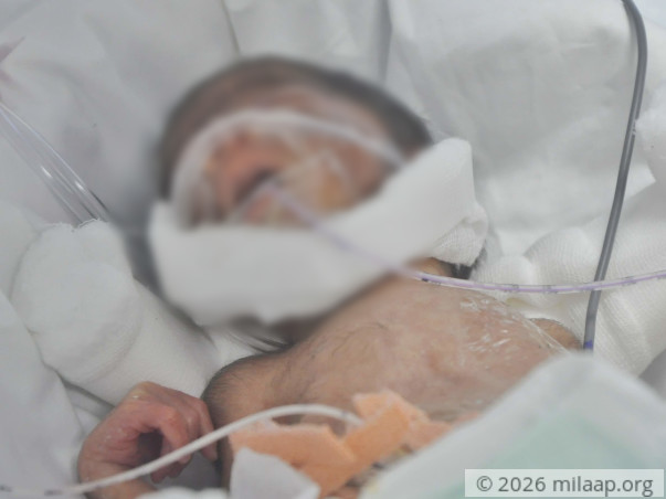 Baby of Dakshayini needs your help to survive