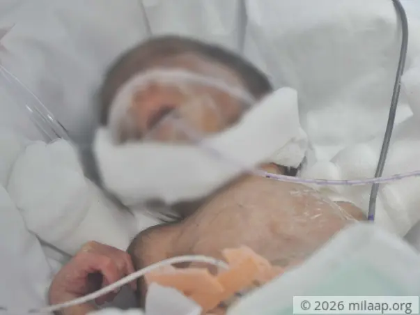 Baby of Dakshayini needs your help to survive