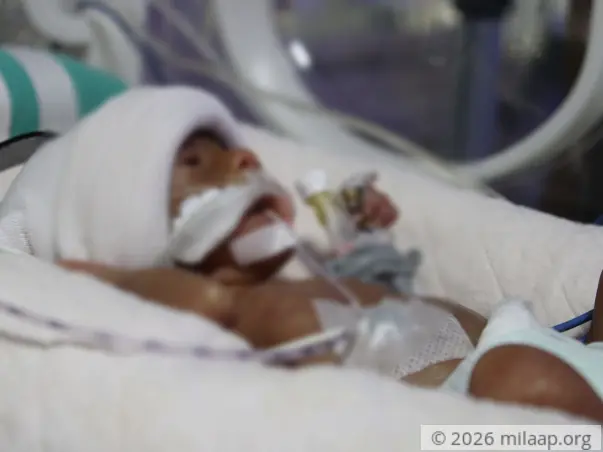 Palm-sized Preemie Fights To Stay Alive While Parents Plead For Help