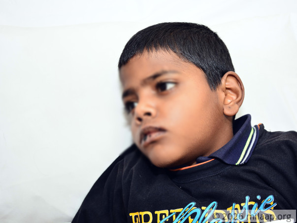 Mohit needs your help to undergo his treatment