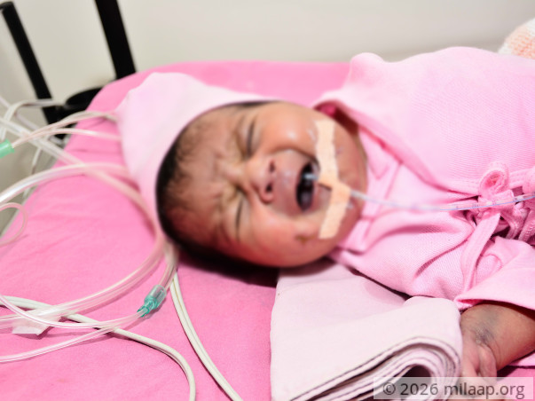 Help 1-Month-Old Who Couldn’t Cry At Birth Due To His Failing Heart