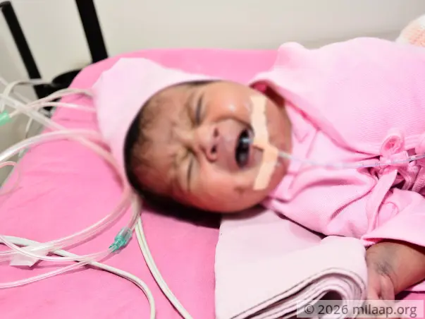 Help 1-Month-Old Who Couldn’t Cry At Birth Due To His Failing Heart