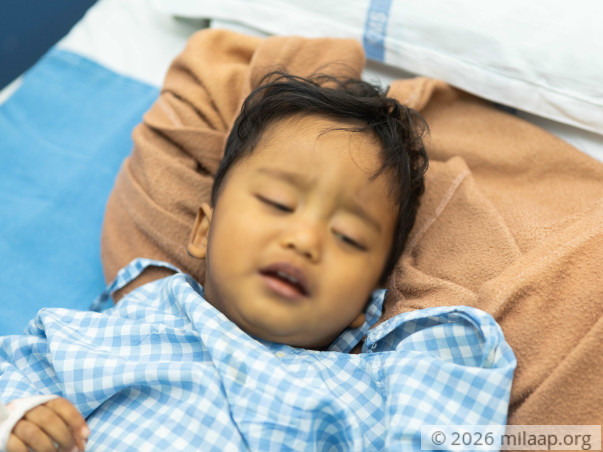 John Anish Advik needs your help to undergo Liver transplant