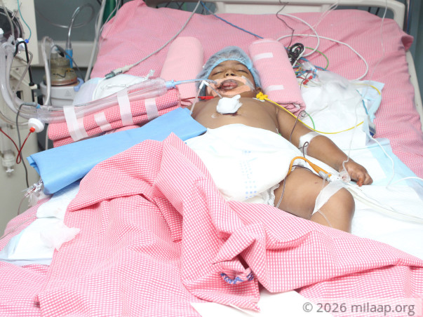 Eshitha needs your help to undergo her treatment