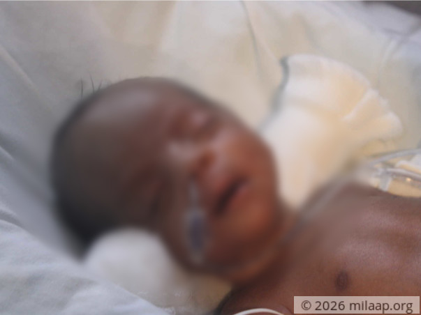 Without Your Help, Newborn Preemie Baby Will Lose Her Twin Sister