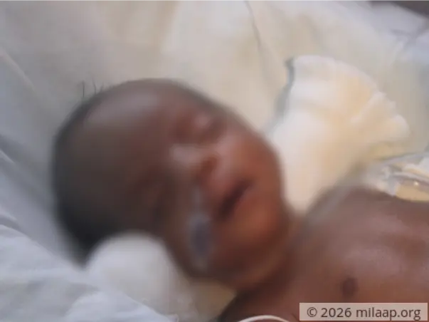 Twin Babies of Jeyakumari Premature needs your help to survive