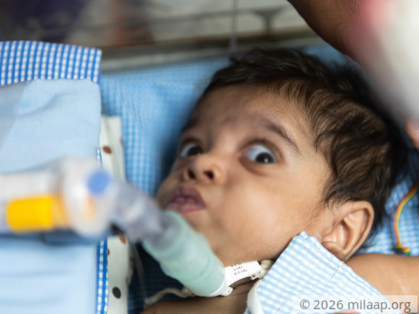 Father Lost Job While Trying To Save Baby, Needs Help To Treat Her