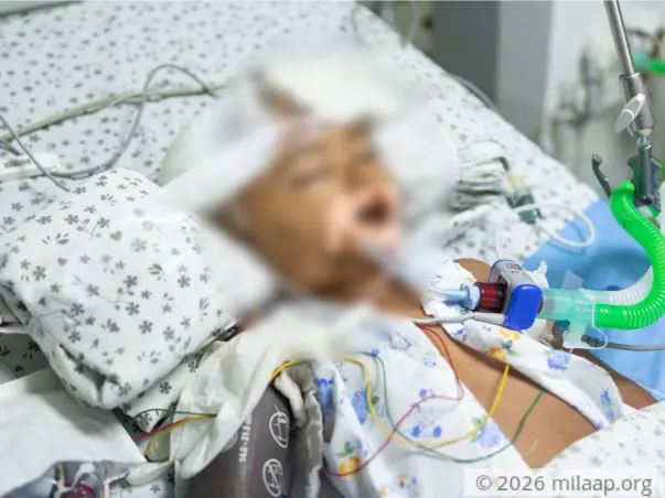 Help Aradhya Undergo An Urgent Decompressive Craniotomy