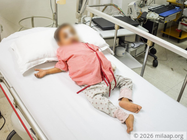 Help Rudra Fight Biliary Atresia with a lifesaving Liver Transplant