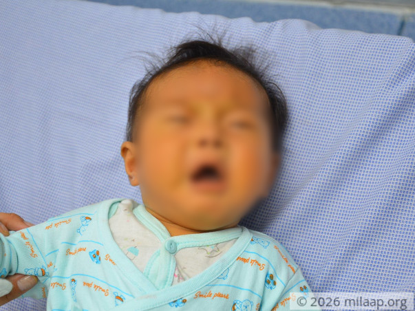 Suddenly, Their Baby Is In The Clutches Of Death Due To Liver Disease