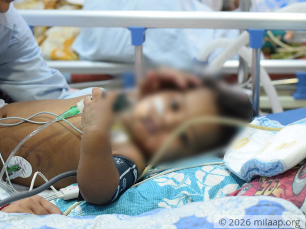 This Baby Spent His First Birthday In The ICU, His Lungs Are Failing