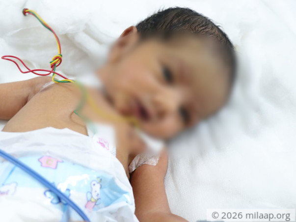24 Hours Is All This Baby Has To Get Surgery And Survive Heart Disease
