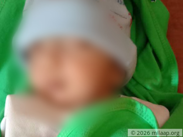 Help Nizam Uddin Fight Acynotic Congenital Heart Disease