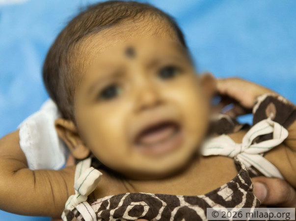 Help Baby Mokshada Fight Biliary Atresia