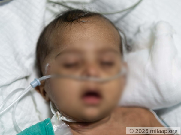 Help Baby of  Chandra Shakar Recover From Pneumonia